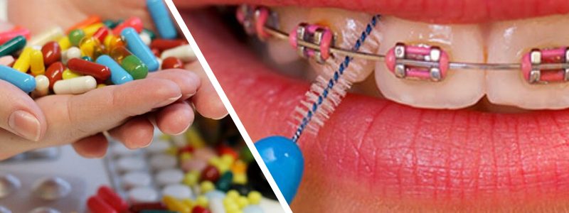 بررسی تاثیر دارو بر ارتودنسی و چگونگی حرکت دندانها