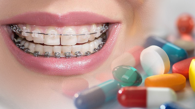 بررسی تاثیر دارو بر ارتودنسی و چگونگی حرکت دندانها | دندانپزشک متخصص اصفهان