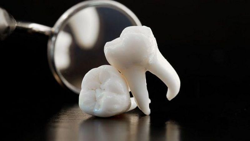 انواع روش های جراحی دندان