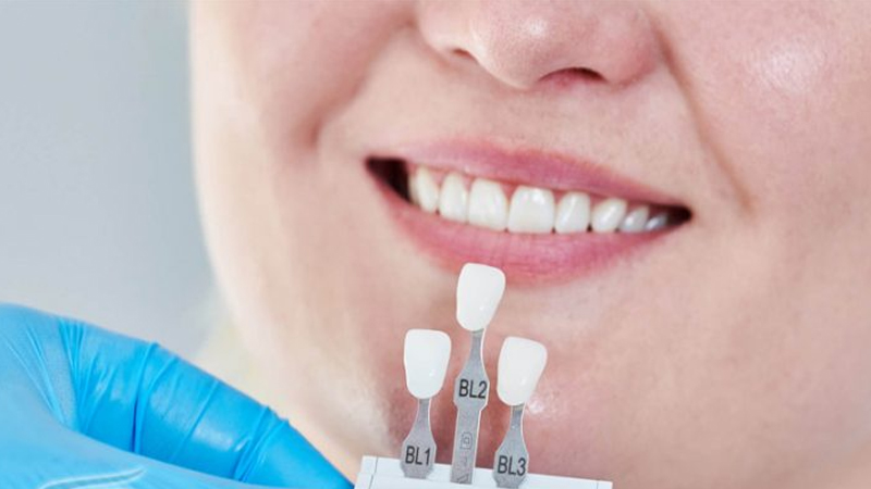نکات مهم در مراقبت از دندانهای روکش شده | دندانپزشک متخصص اصفهان 