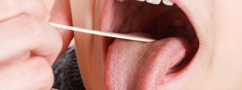 علل و تشخیص موکوسل دهانی